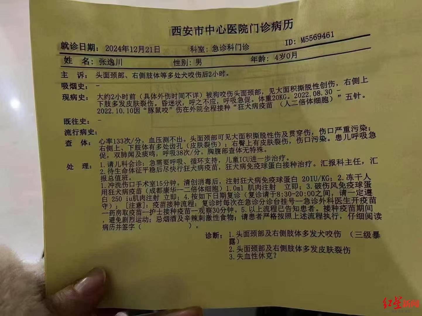 西安4岁男童遭恶犬袭击，致脸部大面积创伤，目前仍在ICU昏迷 警方已在调查犬只来源