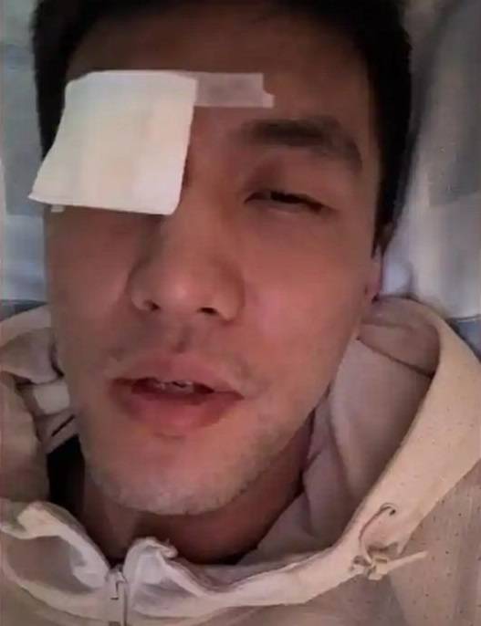 郭艾伦病床上接受采访 ：医生说不会影响以后视力